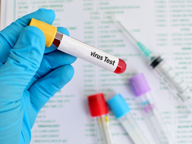 Oswego County Resident in Voluntary Quarantine