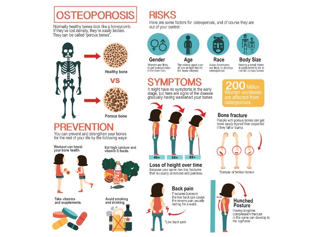 St. Luke Family of Caring Plans Free Bone Density Screening in Fulton Aug 7th