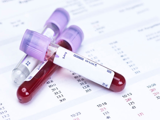 Oswego Health and Fulton Kiwanis Club Team Up To Offer Multi-Organ Blood Analysis