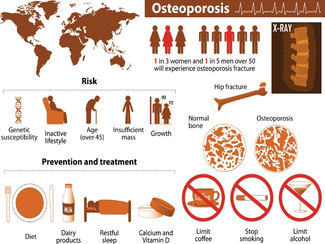 Free Bone Density Screenings to the Public on April 16