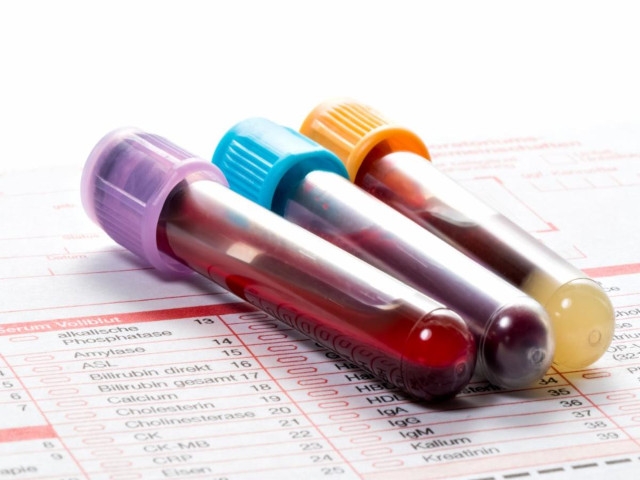 Multi-Organ Blood Analysis Schedule for September